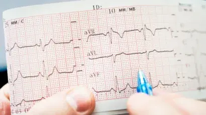 Arritmia cardiaca: ¿en qué consiste? – Adeslas Salud y Bienestar