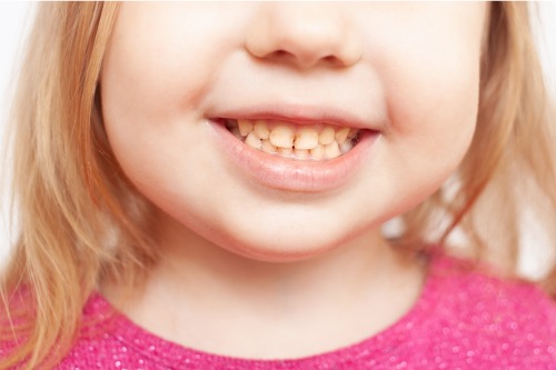 ¿Por qué cambia el color de los dientes de mi hijo? – Adeslas Salud y Bienestar