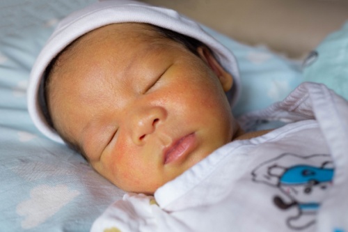 Ictericia neonatal: qué es y cómo tratarla - Adeslas Salud y Bienestar