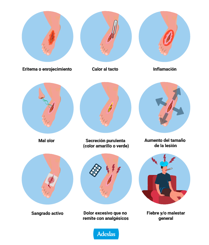 Identificar una infección