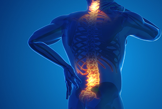 Mujer con dolo de espalda