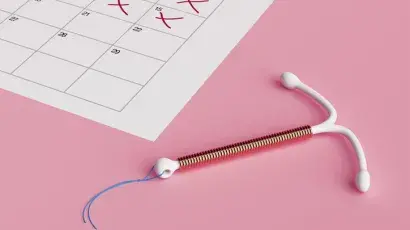 DIU (dispositivo intrauterino): anticonceptivo eficaz de larga duración – Espacio de Salud Adeslas