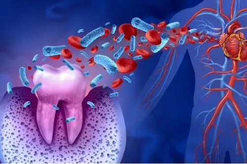¿Existe relación entre la salud oral y las enfermedades cardiovasculares?