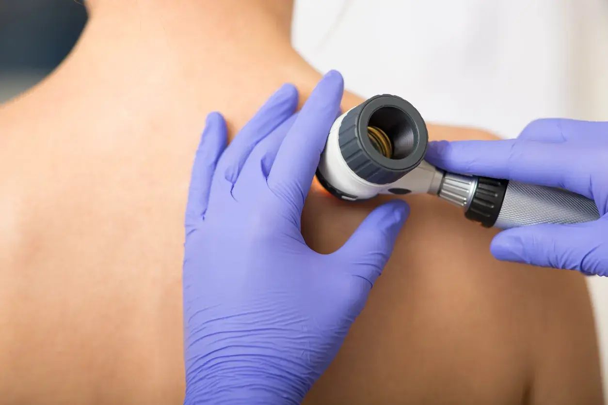 dermatologia
