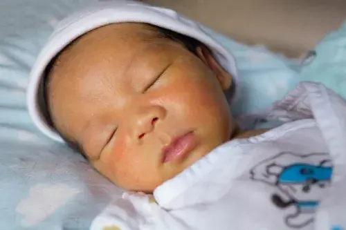 Ictericia neonatal: ¿qué es y cómo tratarla?