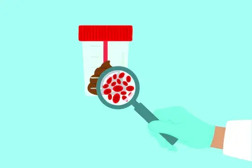 Sang en femtes: causes principals i relació amb el càncer