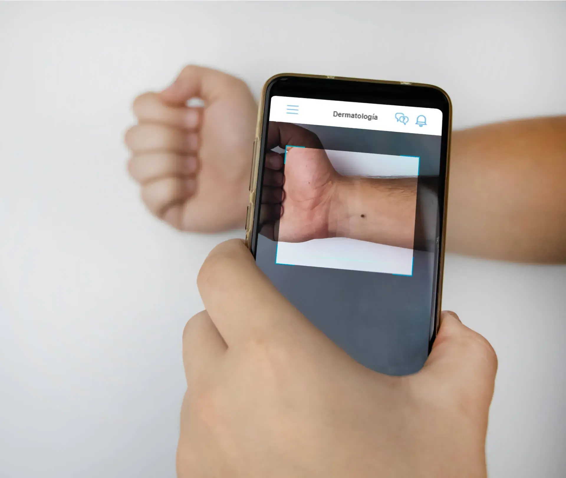 teledermatologia-adeslas